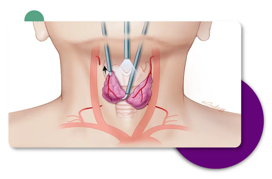 Cervical Spine Surgery in Gurgaon, Delhi - India