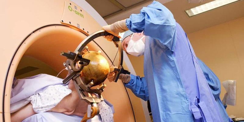 Deep Brain Stimulation doctor in Delhi