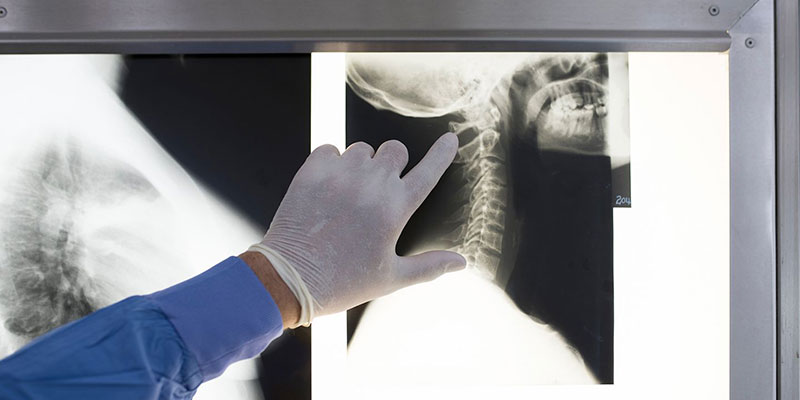 Best Neck Pain Treatment in Delhi
