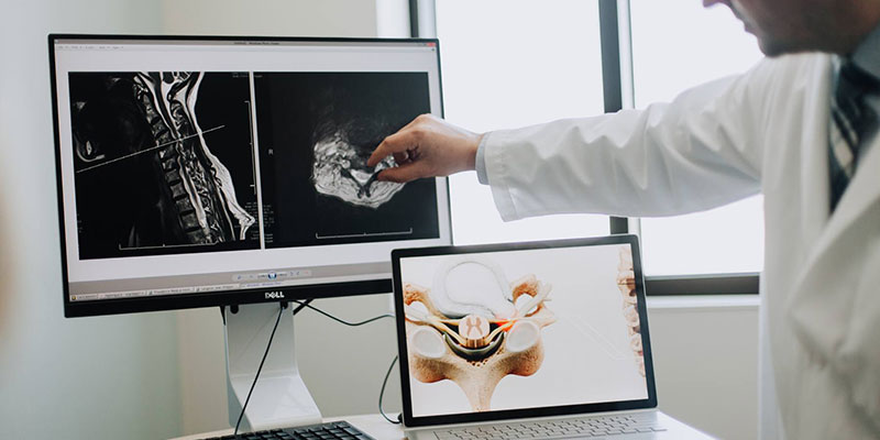 Spine Tumor Treatment Clinic in Delhi