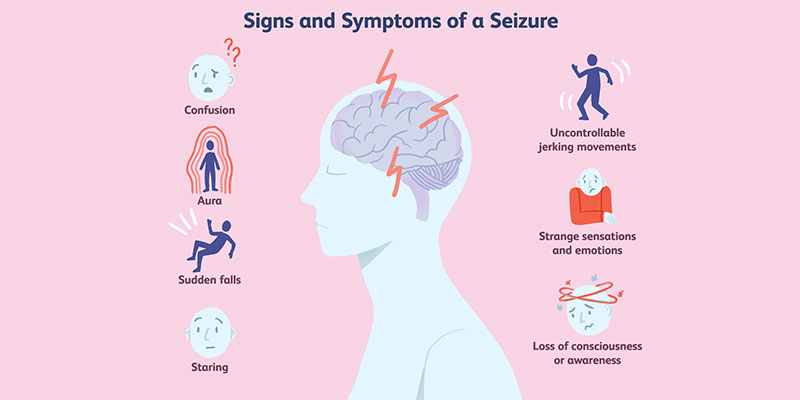 Best Doctor for Epilepsy in India
