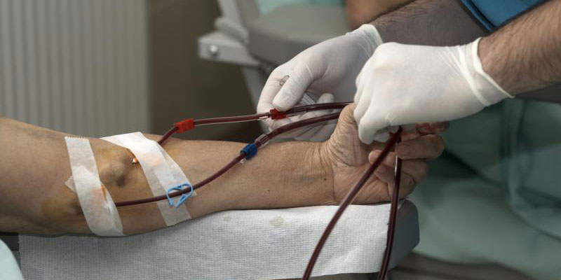Best Hospital for Arteriovenous Fistula in Gurgaon