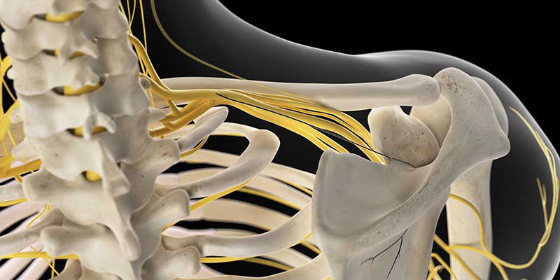 Best Brachial Plexus Injury Treatment in India