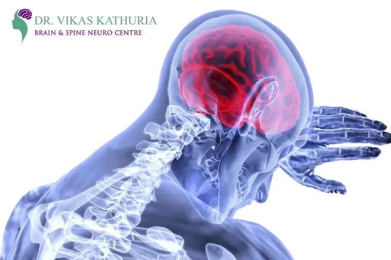 Guidelines for Thrombolytic Therapy for Acute Stroke