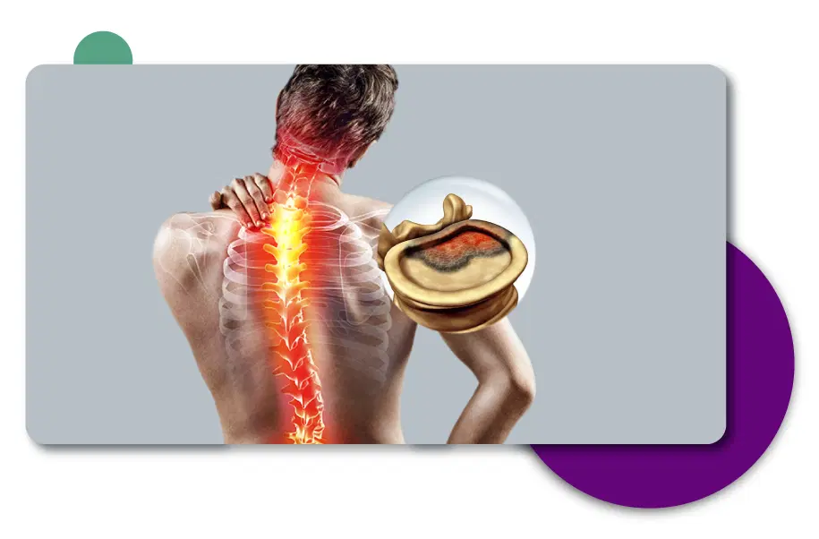 Spine Tumor Treatment in Gurgaon, Delhi - India